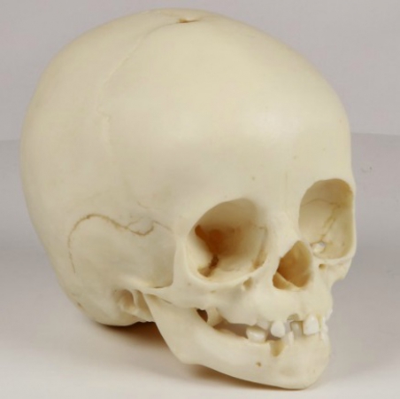 Model czaszki 14-miesięcznego dziecka - Image no.: 2