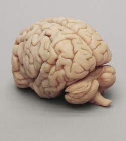 Model mózgu, przekroje czołowe - Image no.: 2