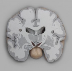 Model mózgu, przekroje czołowe - Image no.: 3
