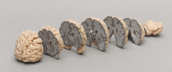 Model mózgu, przekroje czołowe - Image no.: 1