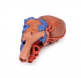 Wydruk anatomiczny - Model serca 3D - Image no.: 4