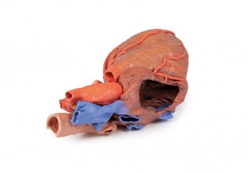 Wydruk anatomiczny - Model serca 3D - Image no.: 6