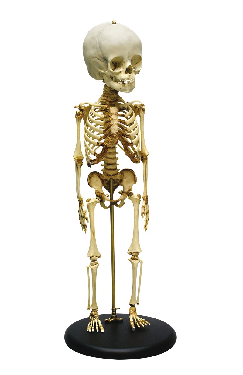 Model szkieletu dziecka w wieku 14-16 miesięcy - Image no.: 1