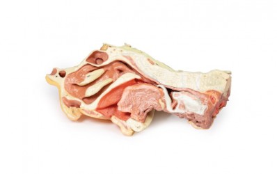 Wydruk anatomiczny 3D - głowa i szyja, połowa twarzy - Image no.: 9