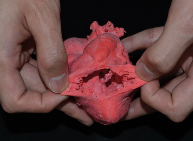 Pediatryczny model serca z transpozycją wielkich naczyń (ccTGA) oraz wadą wrodzoną typu VSD - Image no.: 9