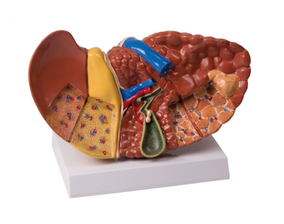 Model wątroby z patologiami - Image no.: 1
