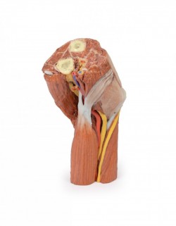 Wydruk anatomiczny  - dół łokciowy, mięśnie, nerwy, tętnica ramienna - Image no.: 2