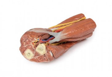 Wydruk anatomiczny  - dół łokciowy, mięśnie, nerwy, tętnica ramienna - Image no.: 6