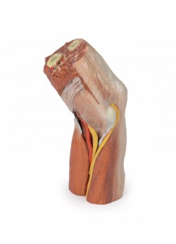 Wydruk anatomiczny  - dół łokciowy, mięśnie, nerwy, tętnica ramienna - Image no.: 1