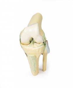 Wydruk  anatomiczny - staw kolanowy w pozycji zgięciowej - Image no.: 2