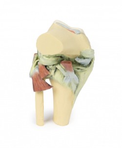 Wydruk anatomiczny - staw kolanowy w pozycji zgięciowej - Image no.: 7