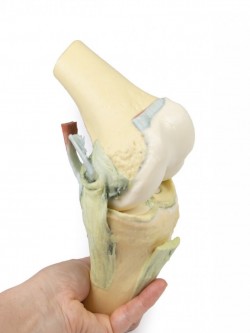 Wydruk anatomiczny - staw kolanowy w pozycji zgięciowej - Image no.: 8