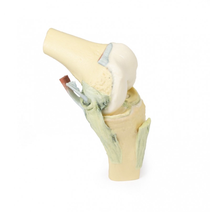 Wydruk  anatomiczny - staw kolanowy w pozycji zgięciowej - Image no.: 1