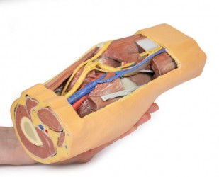 Wydruk  anatomiczny 3D - dół podkolanowy - Image no.: 8
