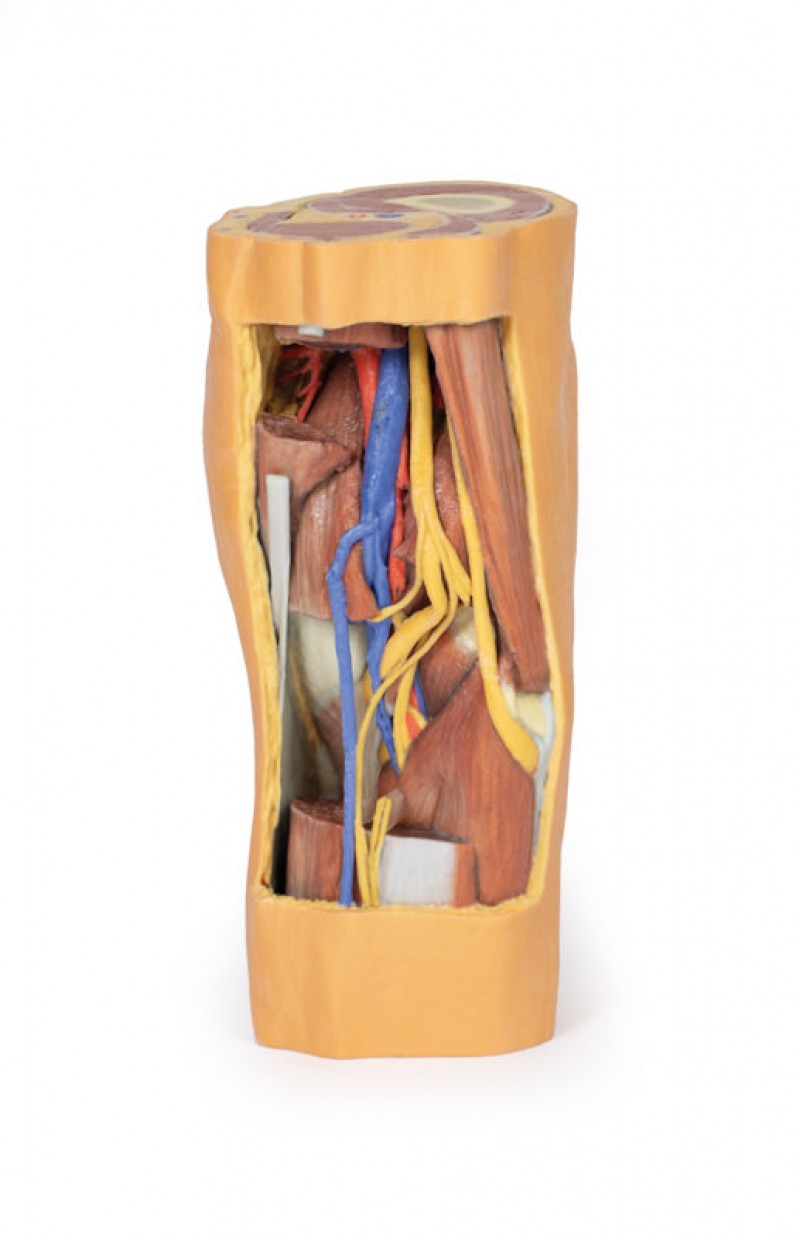Wydruk  anatomiczny 3D - dół podkolanowy - Image no.: 1