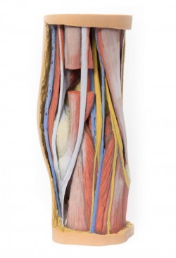 Wydruk anatomiczny 3D - dół podkolanowy - Image no.: 5