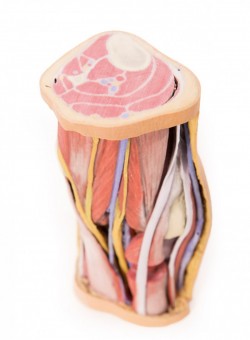Wydruk anatomiczny 3D - dół podkolanowy - Image no.: 1