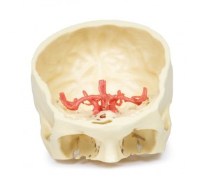 Wydruk anatomiczny 3D - koło tętnicze Willisa - Image no.: 2