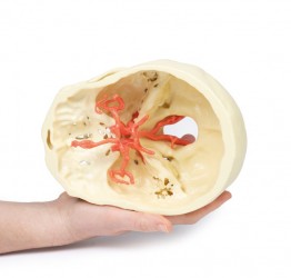 Wydruk anatomiczny 3D - koło tętnicze Willisa - Image no.: 4