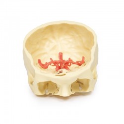 Wydruk anatomiczny 3D - koło tętnicze Willisa - Image no.: 1