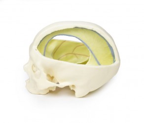 Wydruk anatomiczny 3D - czaszka z oponą twardą - Image no.: 2