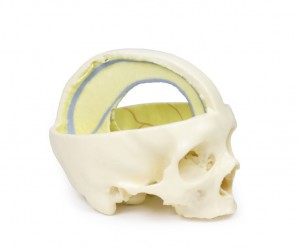 Wydruk anatomiczny 3D - czaszka z oponą twardą - Image no.: 3