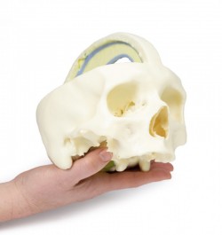 Wydruk anatomiczny 3D - czaszka z oponą twardą - Image no.: 4