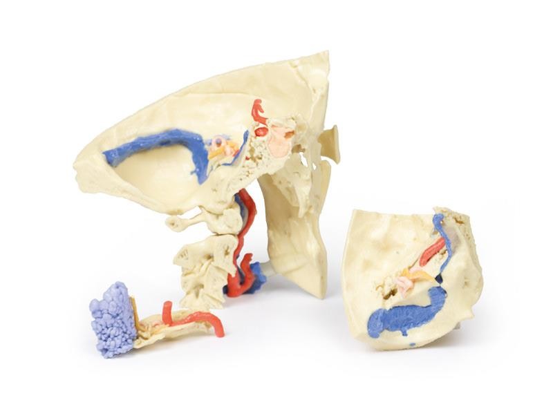 Wydruk anatomiczny - kość skroniowa, aparat słuchowy - Image no.: 1