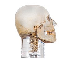 Fantom głowy z kręgami szyjnymi do radiografii (RTG) i CBCT, transparentny - Image no.: 3