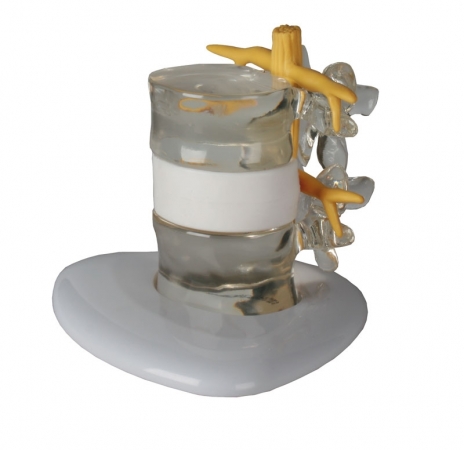 Symulator przepukliny jądra miażdżystego - Image no.: 2