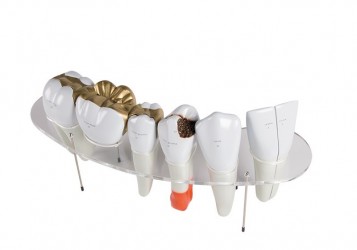 Model zębów, 7 części, powiększenie 10x - Image no.: 1