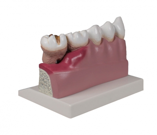 Model zębów, 4x powiększenie - Image no.: 2
