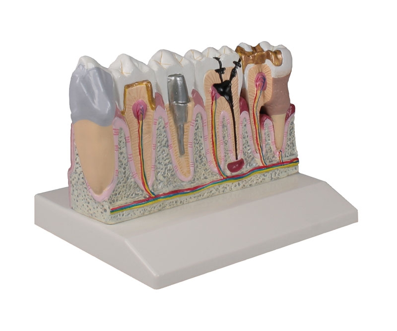 Model zębów, 4x powiększenie - Image no.: 1