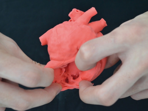 Pediatryczny model serca z wadą typu ASD - ubytek przegrody międzyprzedsionkowej - Image no.: 2