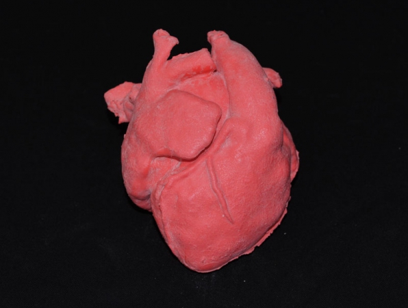 Pediatryczny model serca z transpozycją wielkich naczyń (ccTGA) oraz wadą wrodzoną typu VSD - Image no.: 3