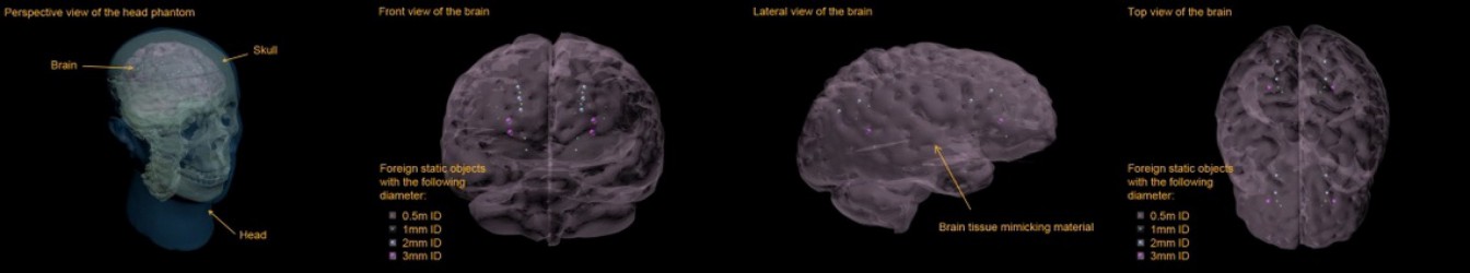 Fantom głowy (Static) do MRI, CT i USG  - Image no.: 2