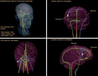 Fantom głowy (Dynamic) do MRI, CT i USG  - Image no.: 2