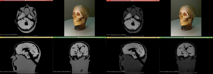Fantom głowy (Dynamic) do MRI, CT i USG  - Image no.: 3