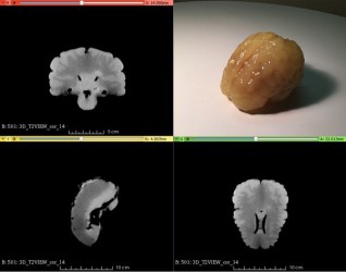 Fantom mózgu do diagnostyki MRI, CT and USG  (Wersja podstawowa) - Image no.: 3