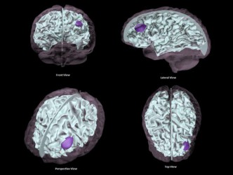 Fantom mózgu do diagnostyki MRI, CT and USG  (Wersja podstawowa) - Image no.: 4
