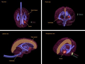Fantom mózgu do USG, CT i MRI (Wersja standard) - Image no.: 2