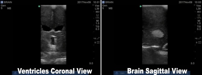 Fantom mózgu do USG, CT i MRI (Wersja standard) - Image no.: 3