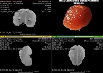 Stwórz własną specyfikację Fantom mózgu do diagnostyki MRI, CT i USG - Image no.: 4