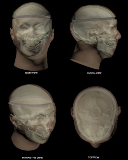 Zaawansowany Fantom głowy (otwieralny) do MRI, CT, USG, RTG oraz medycyny nuklearnej - Image no.: 3