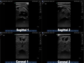 Podstawowy fantom głowy noworodka do ultrasonografii (USG) - Image no.: 3
