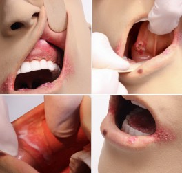 Zaawansowany symulator higieny jamy ustnej z patologiami - Image no.: 4
