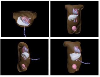 Fantom torsu noworodka do ultrasonografii (USG) - Image no.: 2