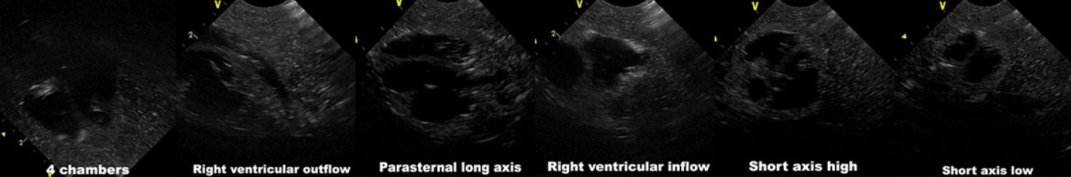 Fantom torsu noworodka do ultrasonografii (USG) - Image no.: 3