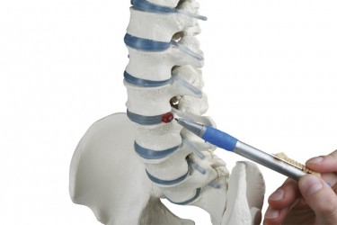 Model kręgosłupa z fragmentami kości udowych (wersja bez statywu) - Image no.: 2