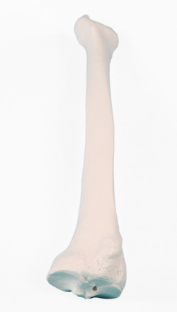 Kość promieniowa - Image no.: 1
